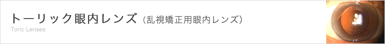 トーリック眼内レンズ